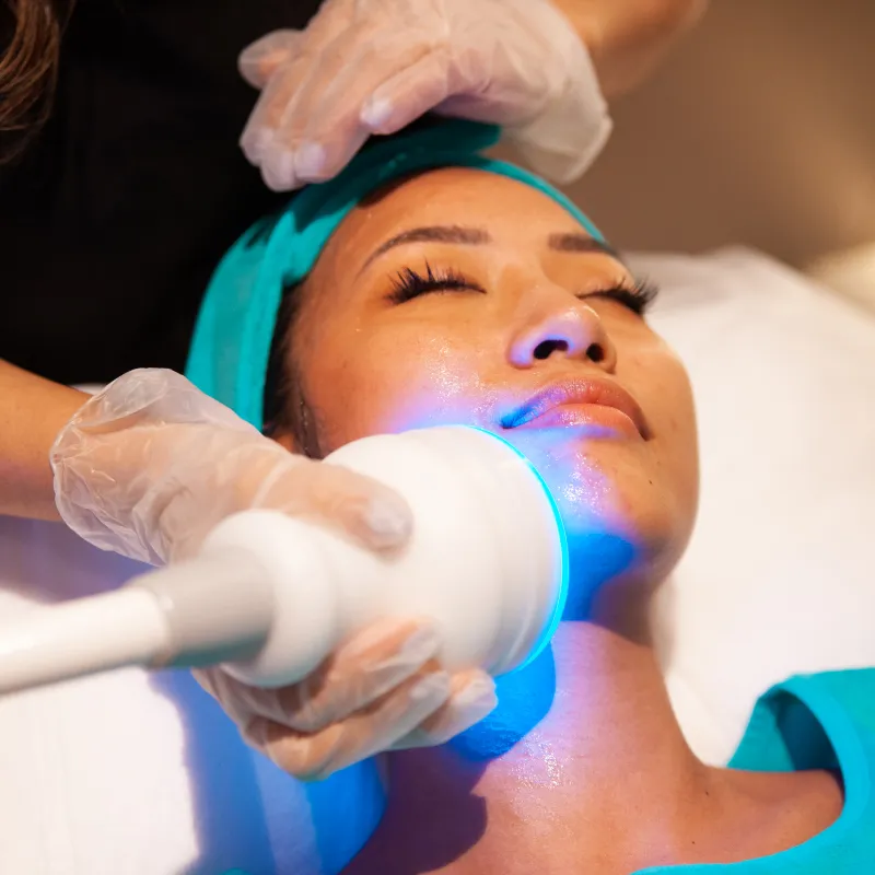 °CRYO Facial