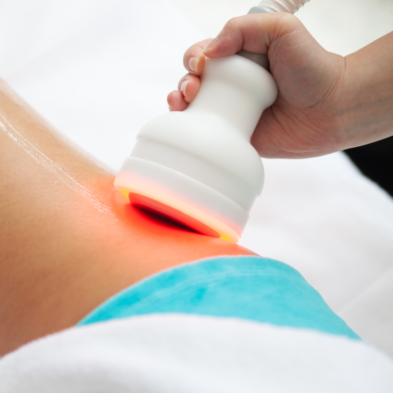 °CRYO Slim Body